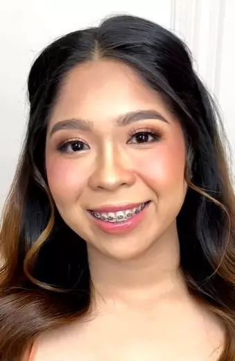 Transformasi makeup tanda lahir di wajah TikTok