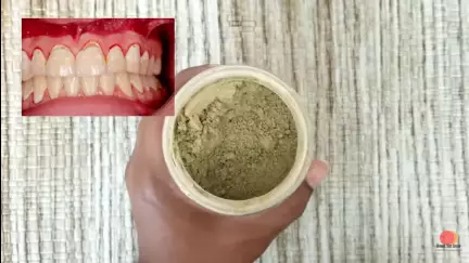 trik mudah rontokkan noda kuning berbagai sumber