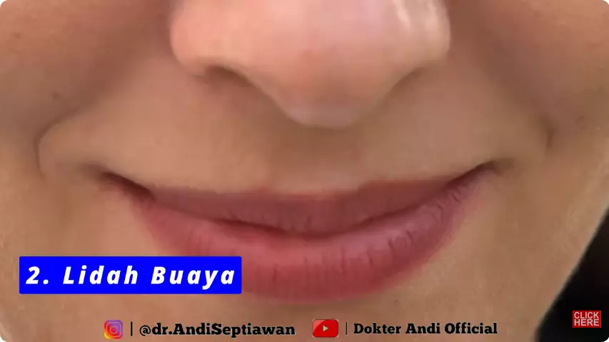 trik ampuh bikin bibir merah alami. berbagai sumber trik ampuh bikin bibir merah alami. berbagai sumber