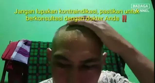 trik menghilangkan rambut beruban berbagai sumber