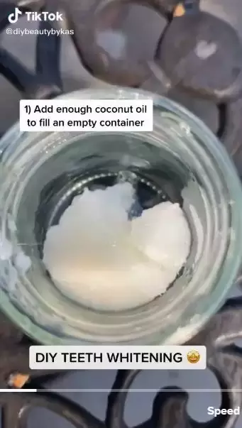 Noda gigi kuning jadi putih bersinar Berbagai sumber Noda gigi kuning jadi putih bersinar Berbagai sumber