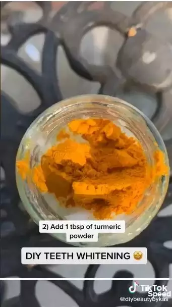 Noda gigi kuning jadi putih bersinar Berbagai sumber Noda gigi kuning jadi putih bersinar Berbagai sumber