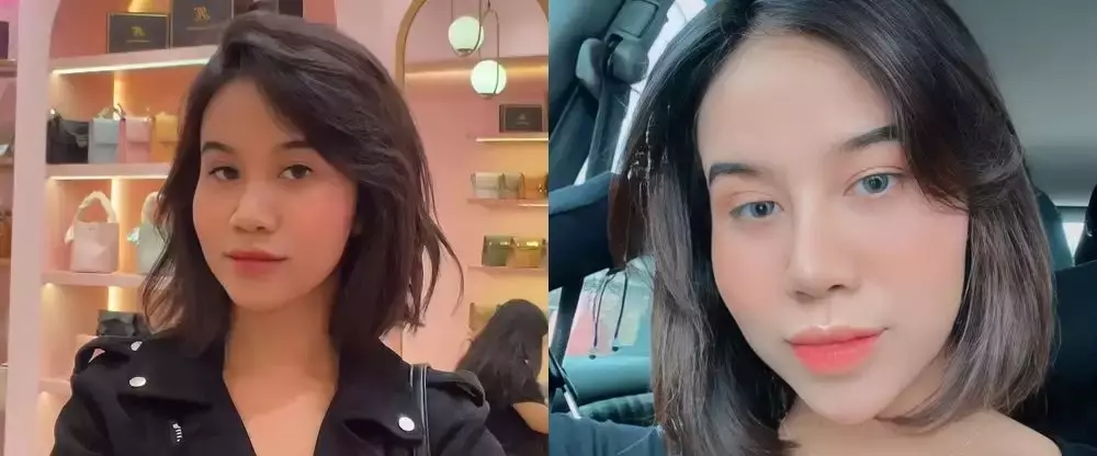 Potret wajah 23 seleb sebelum dan sesudah operasi plastik berbagai sumber