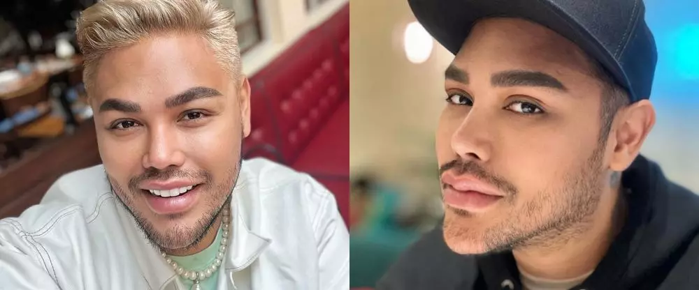 Potret wajah 23 seleb sebelum dan sesudah operasi plastik berbagai sumber