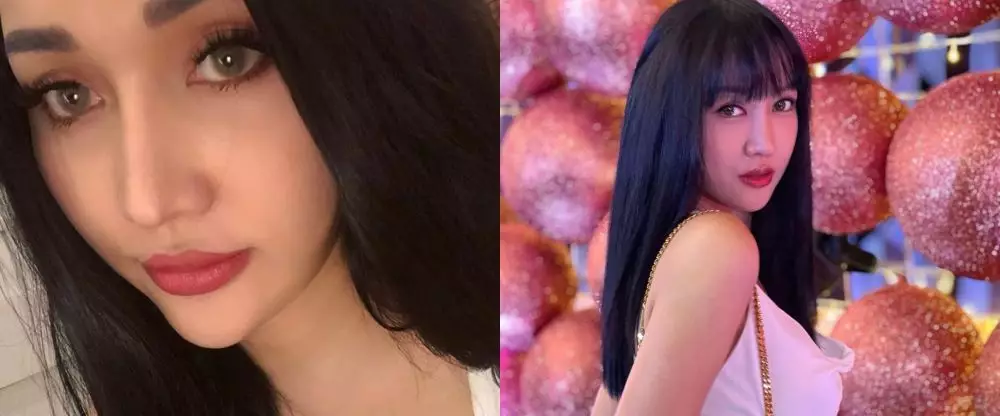 Potret wajah 23 seleb sebelum dan sesudah operasi plastik berbagai sumber