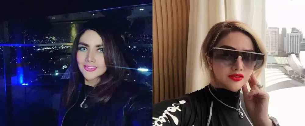 Potret wajah 23 seleb sebelum dan sesudah operasi plastik berbagai sumber