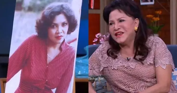 Potret wajah 23 seleb sebelum dan sesudah operasi plastik berbagai sumber