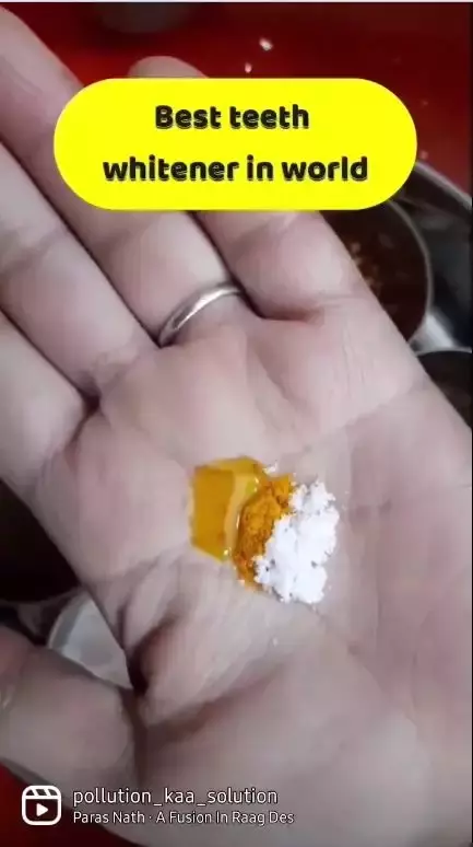 Hilangkan plak di gigi penebalan Berbagai sumber