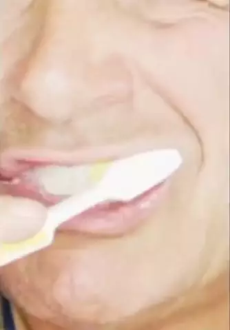 Hilangkan noda kekuningan pada gigi Berbagai sumber