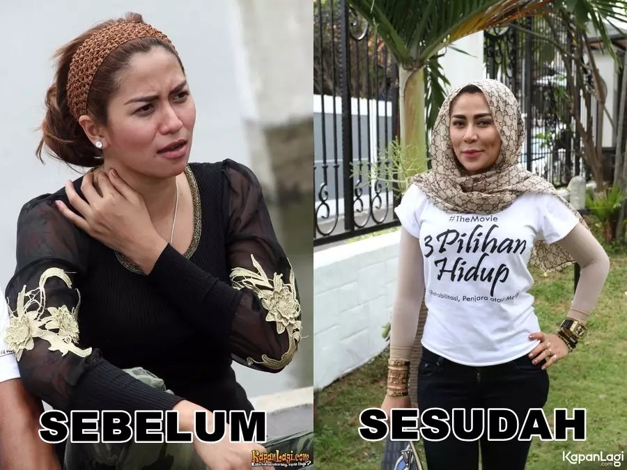 Seleb sebelum dan sesudah lakukan filler Berbagai sumber