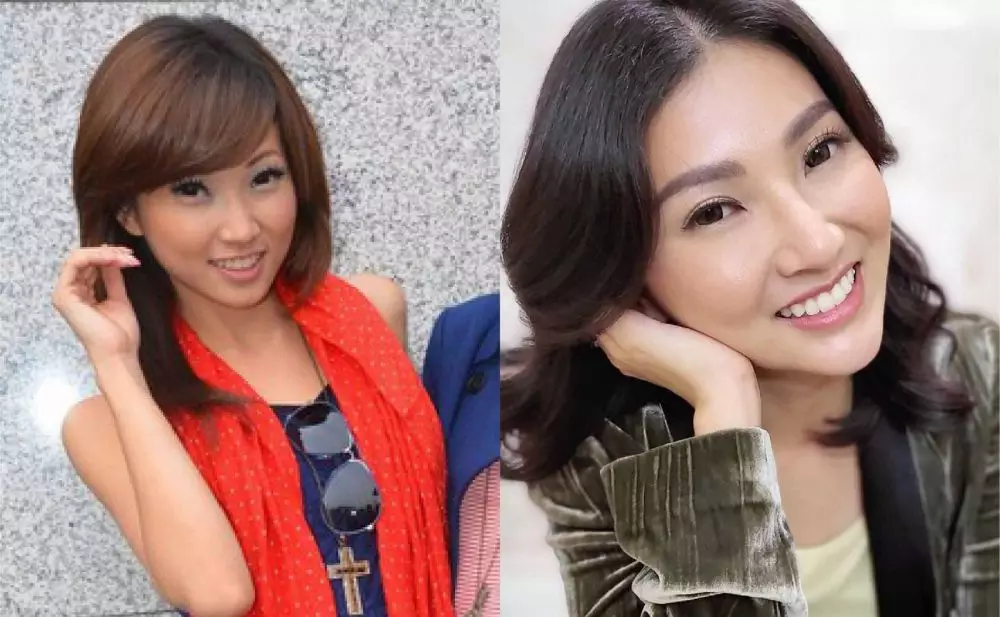 Seleb sebelum dan sesudah lakukan filler Berbagai sumber