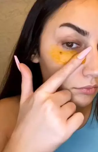 Atasi kerutan dan mata panda pakai kunyit Berbagai sumber