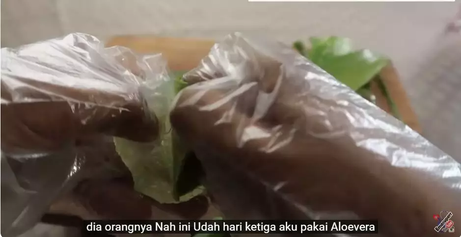 cara hilangkan jerawat berbagai sumber