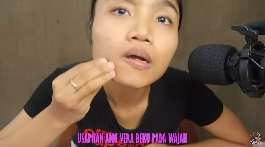 cara hilangkan jerawat berbagai sumber