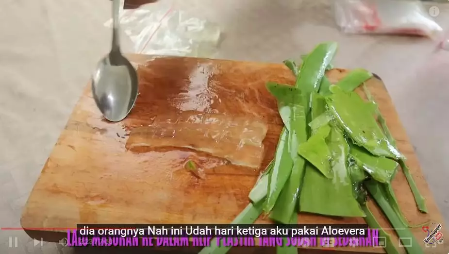 cara hilangkan jerawat berbagai sumber