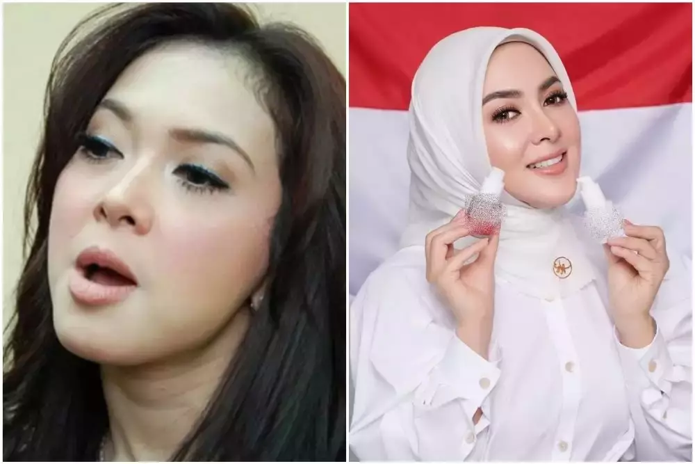 Seleb sebelum dan sesudah lakukan sulam alis Berbagai sumber Seleb sebelum dan sesudah lakukan sulam alis Berbagai sumber