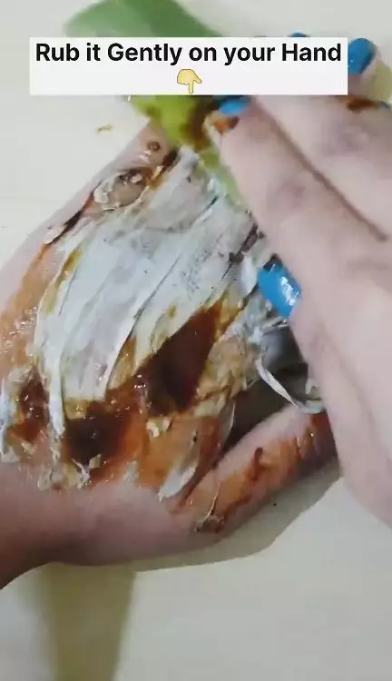 ratakan warna kulit belang berbagai sumber