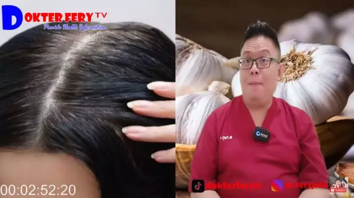 tunjukan cara atasi rambut rontok berbagai sumber