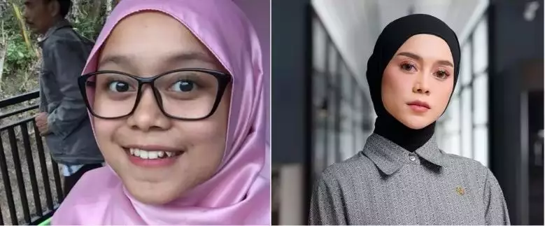 Potret 13 penyanyi sebelum dan sesudah tanam benang berbagai sumber Potret 13 penyanyi sebelum dan sesudah tanam benang berbagai sumber