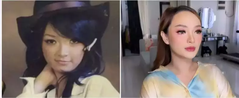 Potret 13 penyanyi sebelum dan sesudah tanam benang berbagai sumber Potret 13 penyanyi sebelum dan sesudah tanam benang berbagai sumber