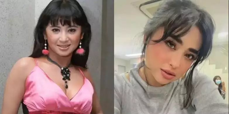 Potret 13 penyanyi sebelum dan sesudah tanam benang berbagai sumber Potret 13 penyanyi sebelum dan sesudah tanam benang berbagai sumber