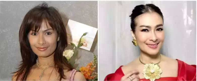 Potret 13 penyanyi sebelum dan sesudah tanam benang berbagai sumber Potret 13 penyanyi sebelum dan sesudah tanam benang berbagai sumber