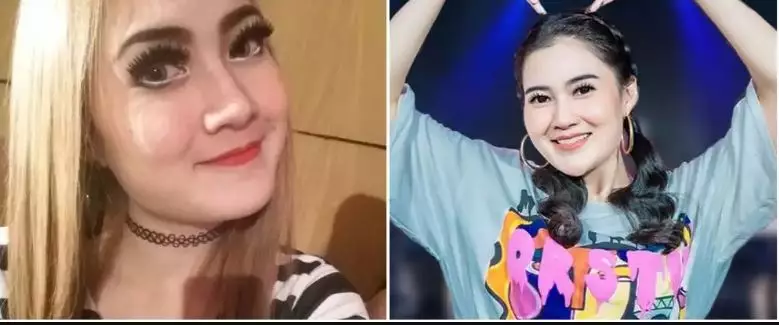 Potret 13 penyanyi sebelum dan sesudah tanam benang berbagai sumber Potret 13 penyanyi sebelum dan sesudah tanam benang berbagai sumber