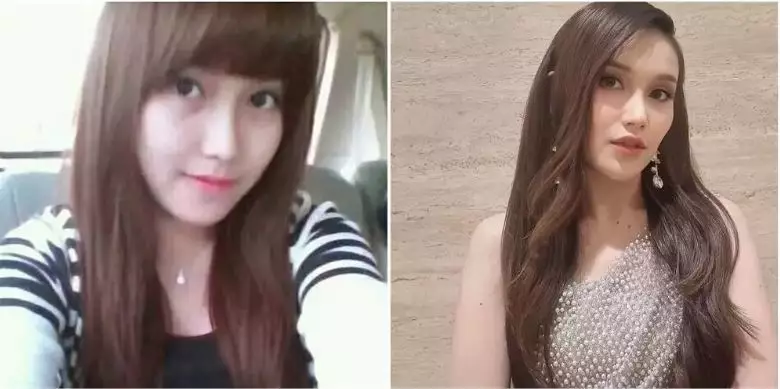 Potret 13 penyanyi sebelum dan sesudah tanam benang berbagai sumber Potret 13 penyanyi sebelum dan sesudah tanam benang berbagai sumber