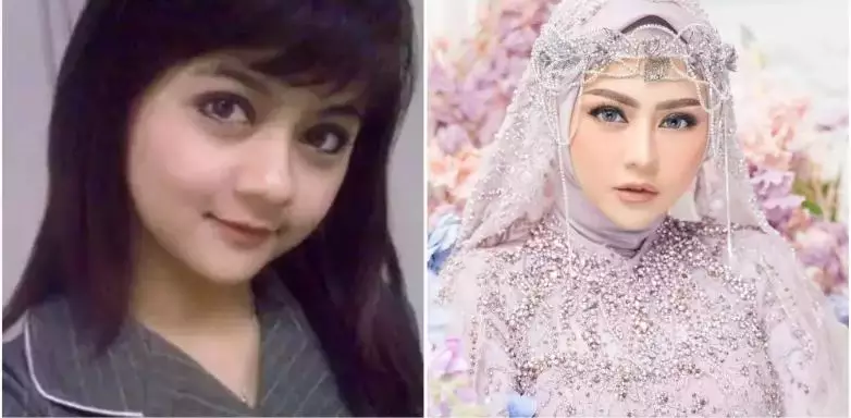 Potret 13 penyanyi sebelum dan sesudah tanam benang berbagai sumber Potret 13 penyanyi sebelum dan sesudah tanam benang berbagai sumber