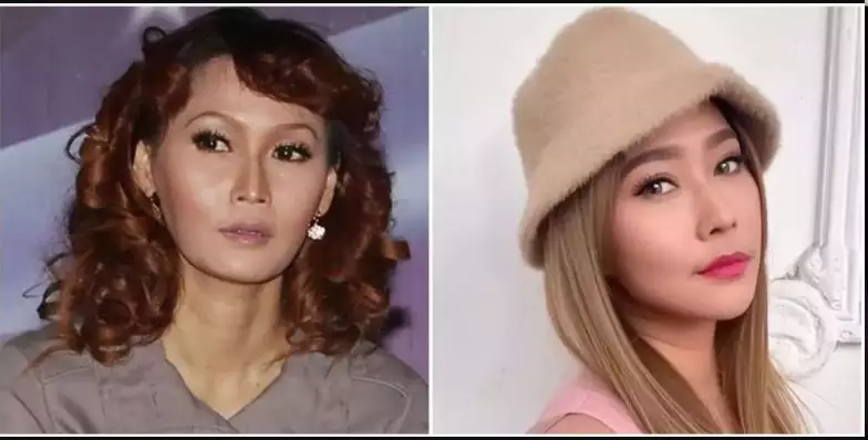 Potret 13 penyanyi sebelum dan sesudah tanam benang berbagai sumber Potret 13 penyanyi sebelum dan sesudah tanam benang berbagai sumber