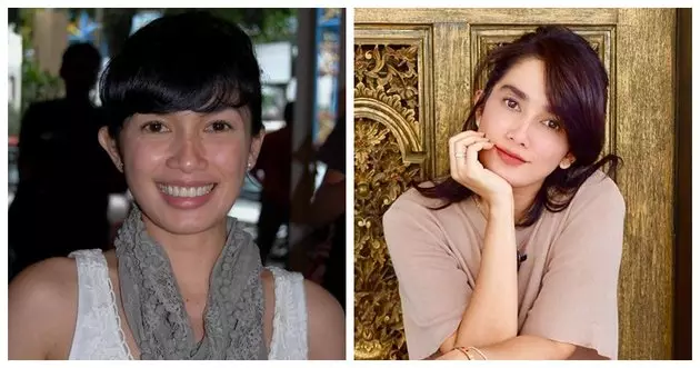 Potret 13 penyanyi sebelum dan sesudah tanam benang berbagai sumber Potret 13 penyanyi sebelum dan sesudah tanam benang berbagai sumber