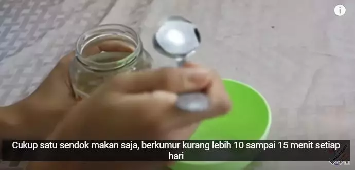 Memutihkan gigi kuning dan berplak menurut dokter Berbagai sumber