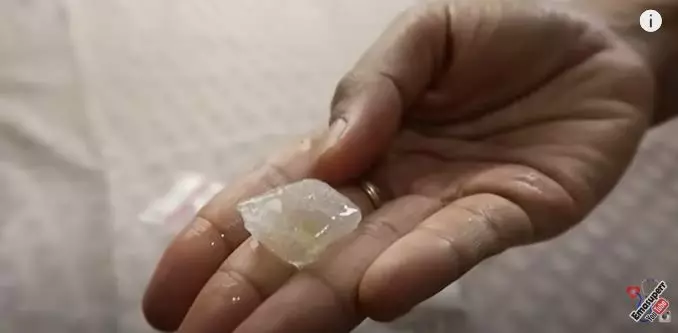 Atasi jerawat meradang rekomendasi dokter Berbagai sumber Atasi jerawat meradang rekomendasi dokter Berbagai sumber