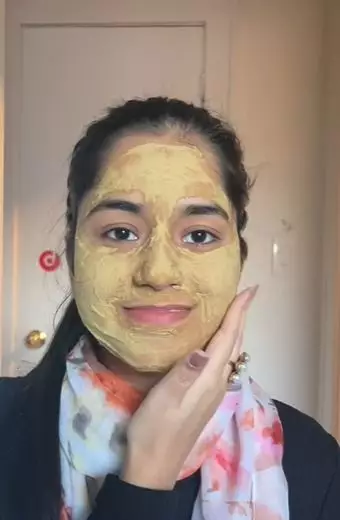 Wanita India ini hilangkan flek hitam Berbagai sumber Wanita India ini hilangkan flek hitam Berbagai sumber