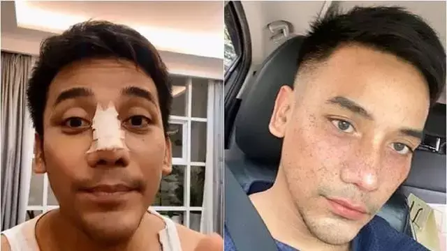 13 potret wajah seleb perubahan dagu Berbagai sumber 13 potret wajah seleb perubahan dagu Berbagai sumber