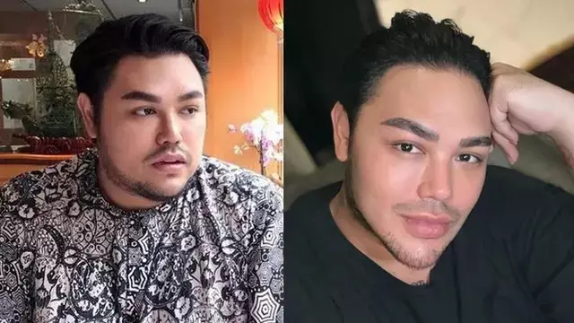 13 potret wajah seleb perubahan dagu Berbagai sumber 13 potret wajah seleb perubahan dagu Berbagai sumber