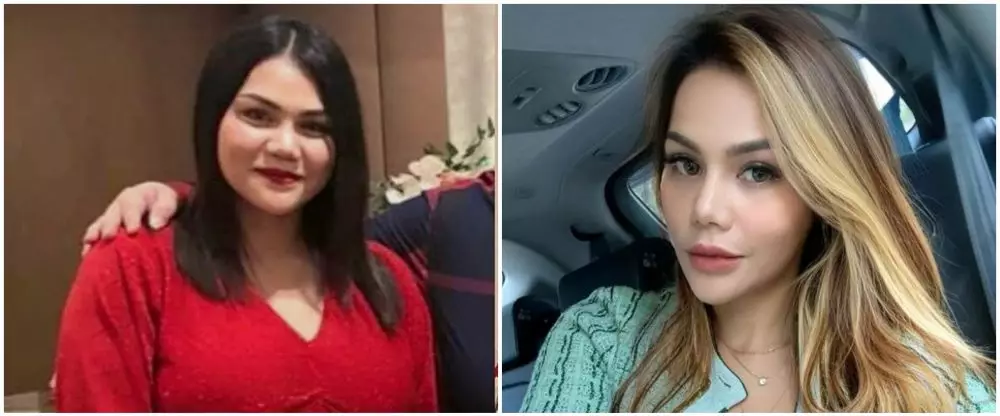 13 potret wajah seleb perubahan dagu Berbagai sumber 13 potret wajah seleb perubahan dagu Berbagai sumber