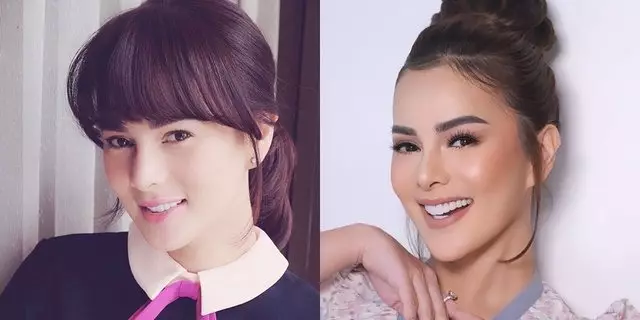 13 potret wajah seleb perubahan dagu Berbagai sumber