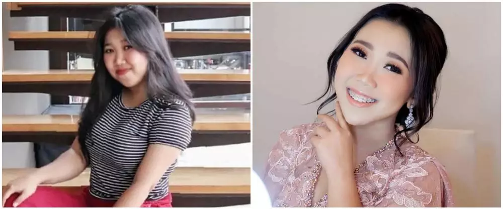 13 potret wajah seleb perubahan dagu Berbagai sumber 13 potret wajah seleb perubahan dagu Berbagai sumber