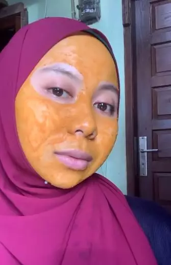 Kencangkan wajah keriput ala wanita berhijab Berbagai sumber Kencangkan wajah keriput ala wanita berhijab Berbagai sumber