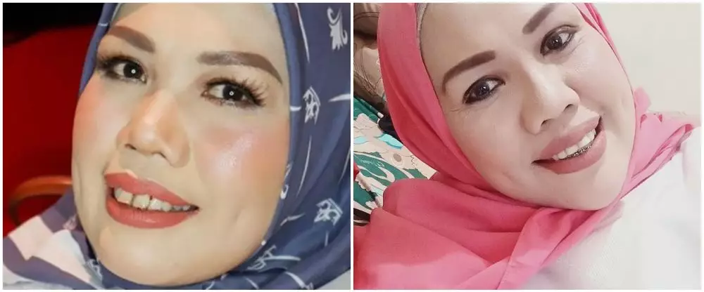 Potret dulu dan kini 11 seleb pakai behel berbagai sumber Potret dulu dan kini 11 seleb pakai behel berbagai sumber