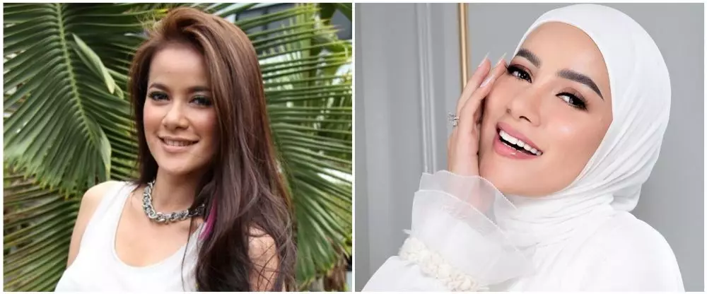 19 Seleb sebelum dan sesudah veneer gigi Berbagai sumber