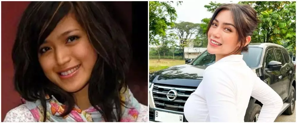 19 Seleb sebelum dan sesudah veneer gigi Berbagai sumber