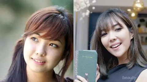 19 Seleb sebelum dan sesudah veneer gigi Berbagai sumber