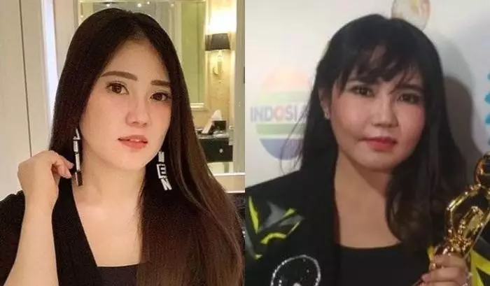 Seleb pernah jadi korban efek samping treatment kecantikan Berbagai sumber