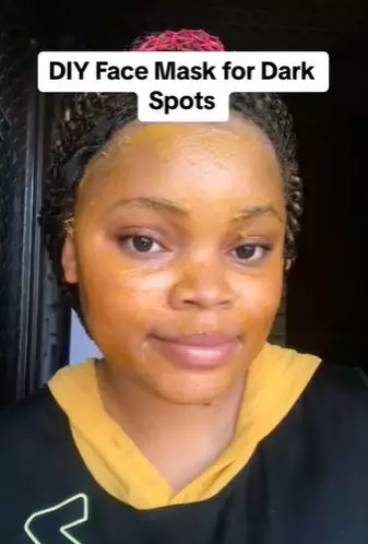 Atasi flek hitam pakai kunyit 2 bahan alami Berbagai sumber