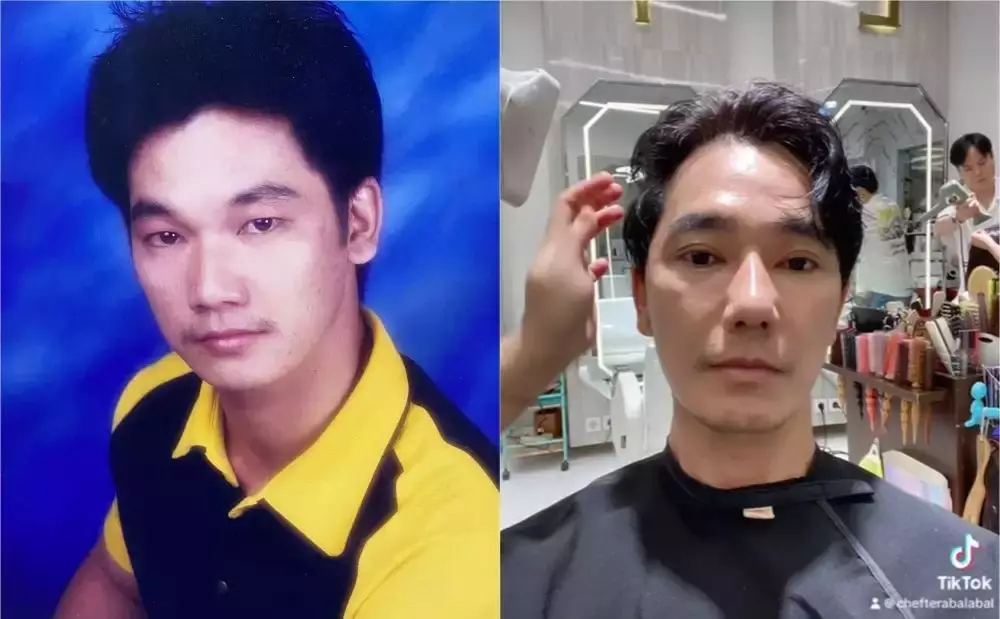 Seleb pria sebelum dan sesudah operasi plastik Berbagai sumber Seleb pria sebelum dan sesudah operasi plastik Berbagai sumber