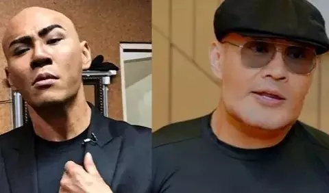 Seleb pria sebelum dan sesudah operasi plastik Berbagai sumber Seleb pria sebelum dan sesudah operasi plastik Berbagai sumber