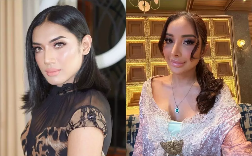 Seleb pria sebelum dan sesudah operasi plastik Berbagai sumber Seleb pria sebelum dan sesudah operasi plastik Berbagai sumber