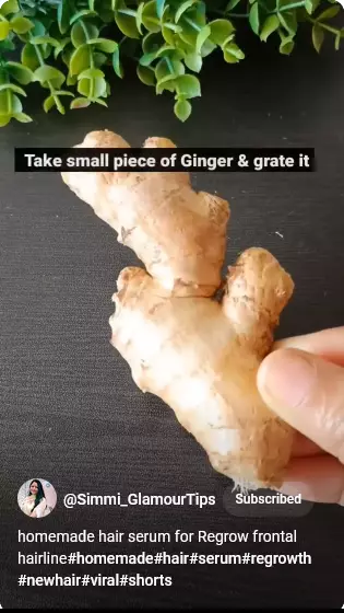 cara menumbuhkan rambut botak samping berbagai sumber